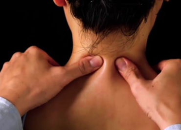 TRỊ LIỆU ĐAU CỔ – VAI – GÁY THEO PHƯƠNG PHÁP DƯỠNG SINH ĐÔNG Y